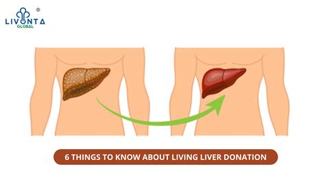 6 Things To Know About Living Liver Donation Livonta Global Pvt Ltd