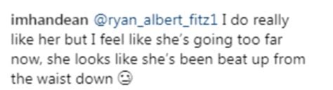 Chloe Ferry Flaunts Her Ample Assets In A TINY Bikini After Fans Blasted Her Liposuction