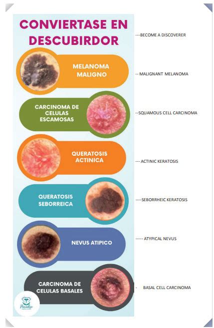 Carcinoma De Células Basales Revista Salud Y Bienestar 1 Sur De