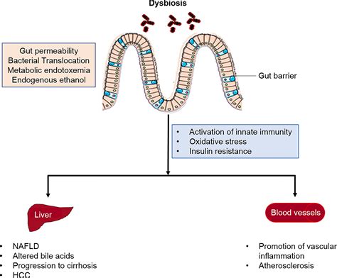 Role Of Gut Microbiota In Liver Disease American Journal Of