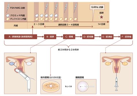 体外受精について（ivf）基礎知識や流れ 豊島区池袋の不妊治療専門なら松本レディースivfクリニック