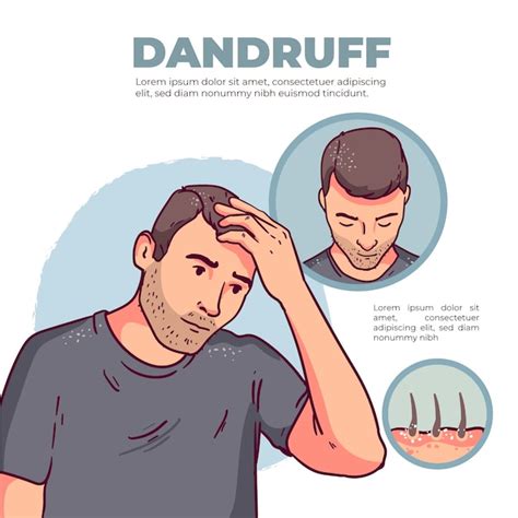 Free Vector Hand Drawn Hair Transplant Infographic