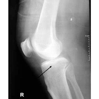 Control lateral knee X-ray | Download Scientific Diagram