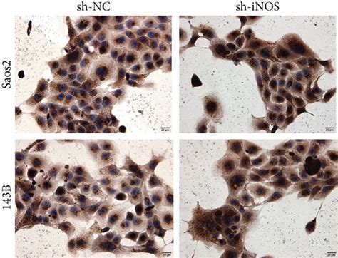 Inos Promotes Os Tumor Growth A Tumorigenesis In Nude Mice