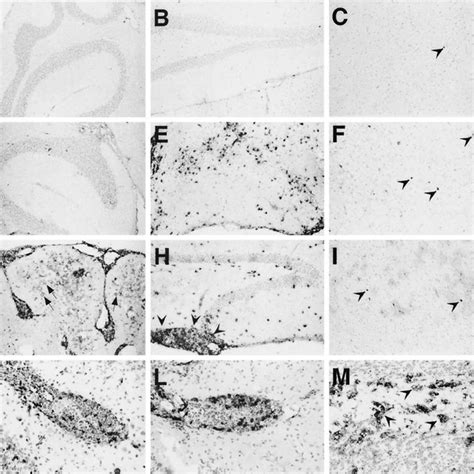 Reduced Viral Antigen Levels In The Cerebellum Of Gf Il Mice Ihc