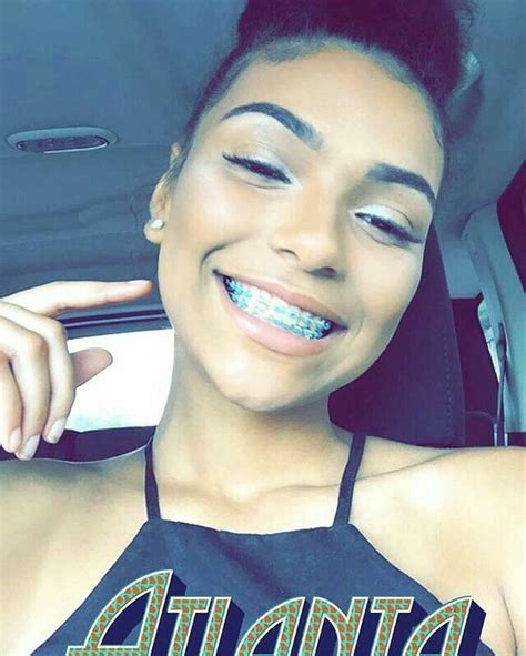 Pinterest Shaylarodneyy Brace Face Cute Braces Cute Girls With Braces