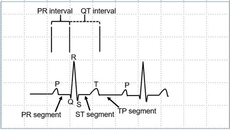 Basic Electrocardiography All About Cardiovascular System And Disorders