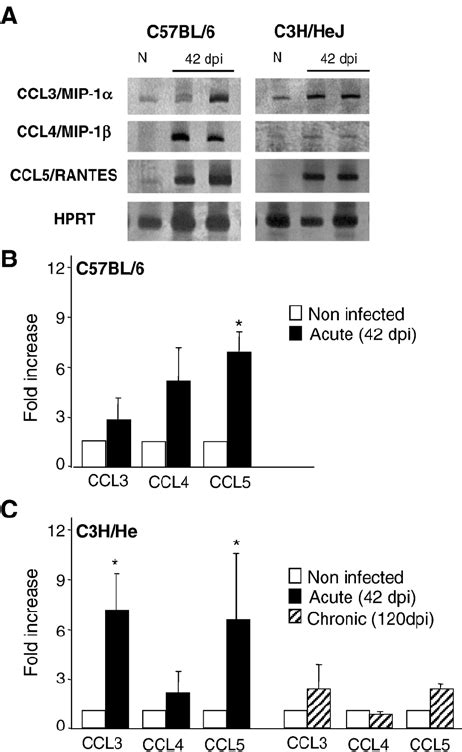 Expression Of Mrna Of Cc Chemokines In The Cns Of Trypanosoma Cruzi