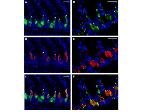 sAC in Na + /K +-ATPase (NKA)-rich and vacuolar-type H +-ATPase ...