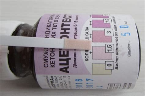 Підвищений ацетон у дітей: волинська лікарка про лікування і те, чого ...