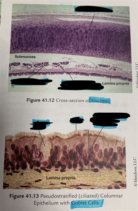 Trachea and Goblet Cells Diagram | Quizlet