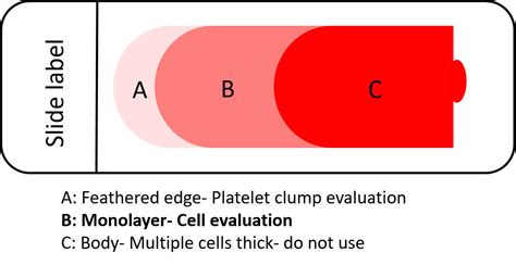 Diagram Of Blood Smear