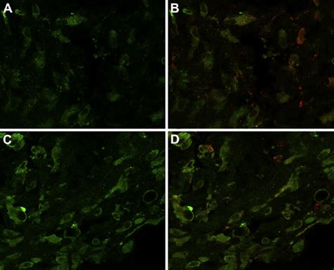 Immunofluorescence double labeling of fibroblast marker Vimentin and ...