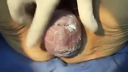 Uretra Se Moze Jebati Free Homemade HD Porn XHamster