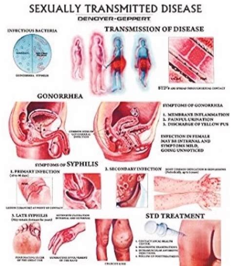 Std With Symptoms And Treatment