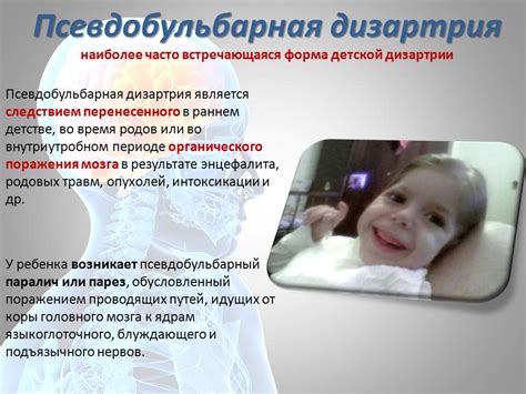 Дизартрия - Презентации по биологии