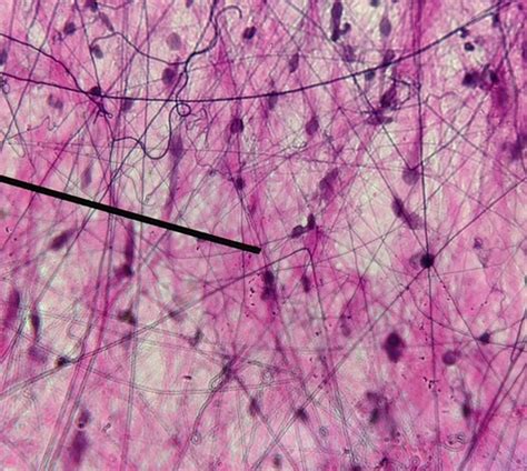 Lab 4-1 & 4-2: Connective and Nervous Tissue Flashcards | Quizlet