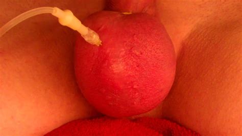 Vorhaut Dehnen Gay Man Porn XHamster