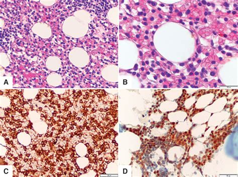 Bone Marrow Cells Histology