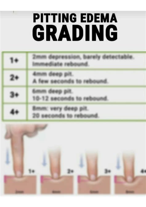 Solution Pitting Edema Grading Studypool