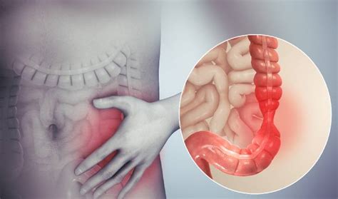 Tipos De Dor No Intestino Que N O Devem Ser Ignoradas Algumas Delas