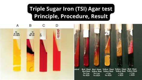 Triple Sugar Iron Tsi Test Principle Procedure Result Biology