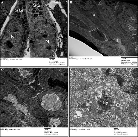 Electron Micrograph Of Ileum From A Control Rat Showing Two Paneth Download Scientific Diagram