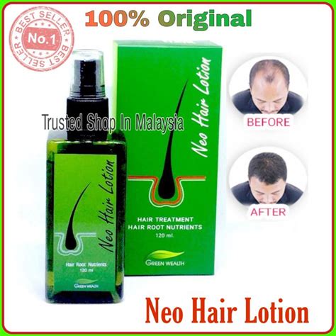 Neo Hair Lotion 100 Original 120ml Hair Spray Hair Transplant And Hair