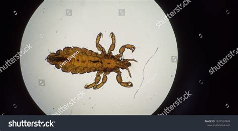 Chicken Lice Under Microscope Stock Photo 1821557849 | Shutterstock