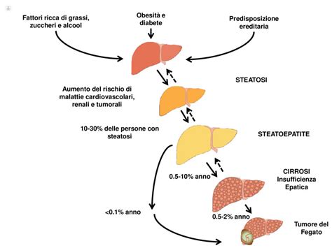 Steatosi Epatica Quando Il Fegato Non Funziona Pi Bene Top Doctors