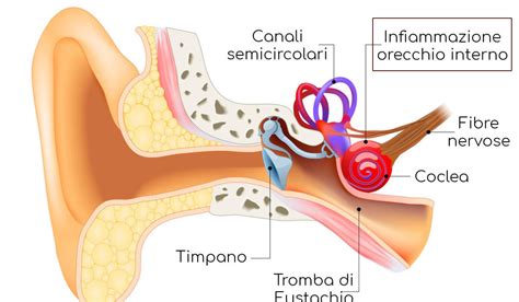 La Sindrome Vestibolare Come Intervenire Con La Riabilitazione