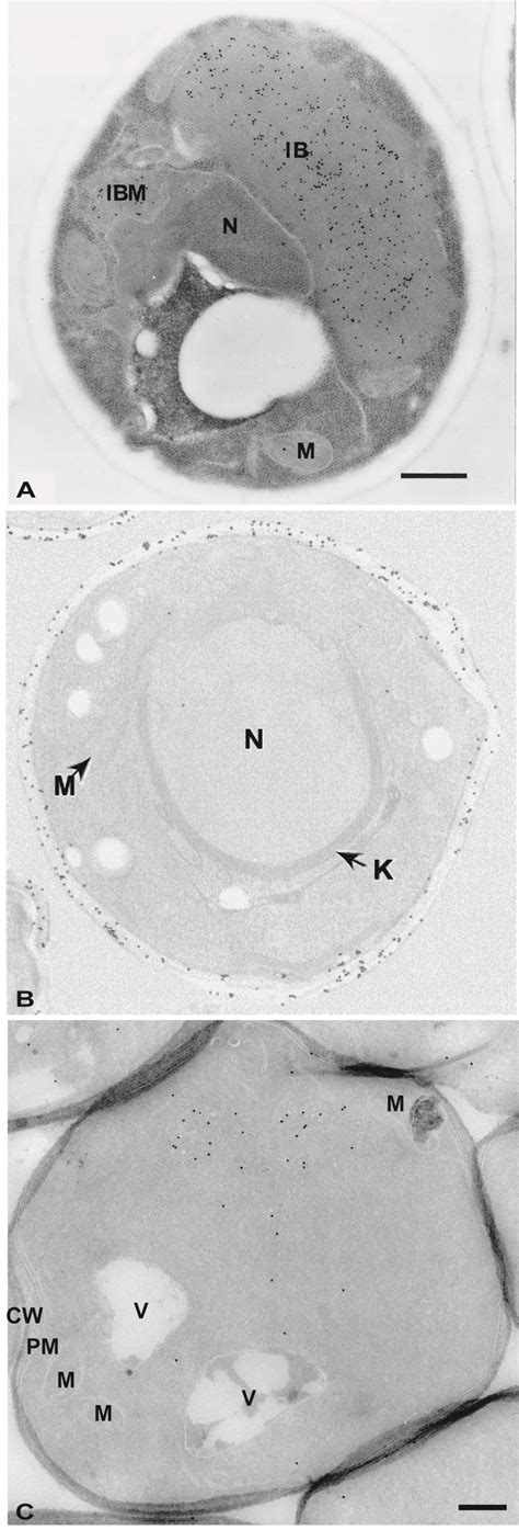 Figure 3 Electron microscopy methods for S. cerevisiae 