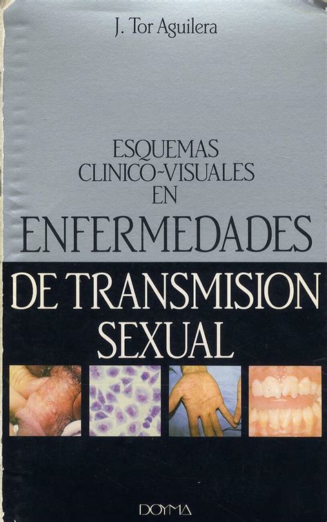 Esquemas clínico visuales en enfermedades de transmisión sexual