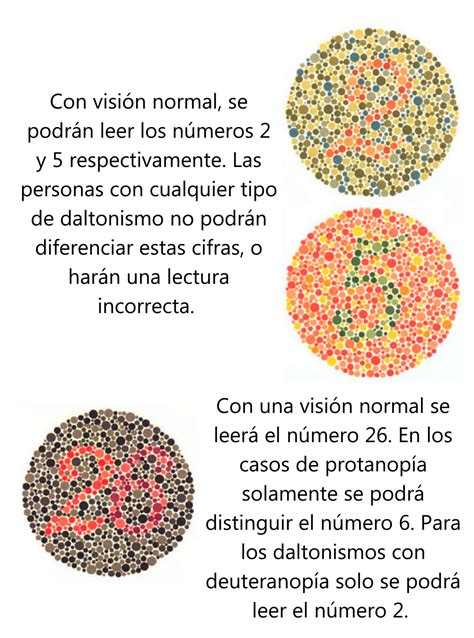 Daltonismo Acromatico - Comprender El Daltonismo: Causas, Síntomas Y Tratamiento – ELDJ