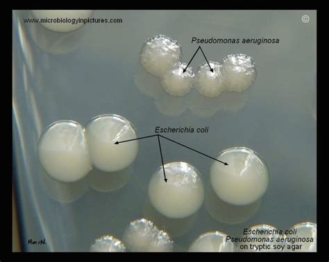 Tryptic soy agar in 2022 | Medical laboratory science, Medical ...