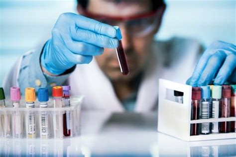 Тропонин-I (Troponin-I, Тн I) - что означает этот показатель в ...