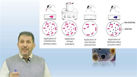 Ziehl-Neelsen Staining- Principle And Procedure With, 40% OFF