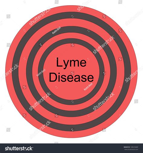 Lyme Disease Red Bullseye Making Great Stock Illustration 138525689 Shutterstock