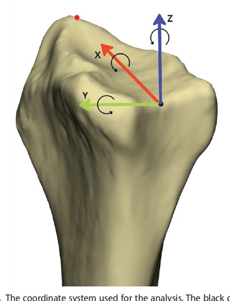 Figure 2 From Improving Standard Volar Plate Fixation In 3D Guided