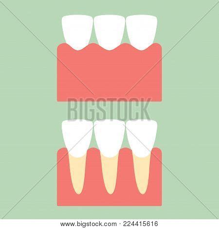 Healthy Incisor Tooth Vector Photo Free Trial Bigstock