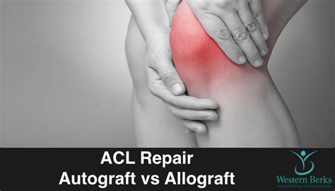 ACL Repair Autograft Vs Allograft Therapist Office, Physical Therapist ...