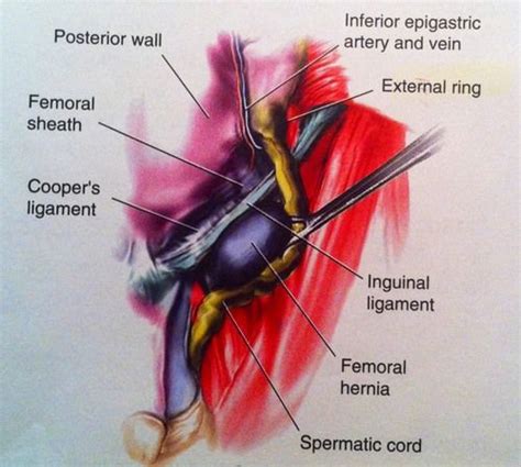 Surgical Technology General Surgery Flashcards General Surgery