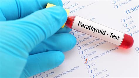 Parathormon Pth Merkmale Bedeutung Und Werte