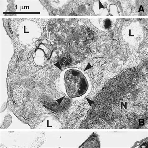 Plasmodium Sporozoites Attach To And Enter Kupffer Cells But Not