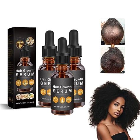 I Tested The Top Products For Black Hair Growth And Heres The Winner