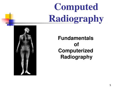 Ppt Digital Radiography Powerpoint Presentation Free Download Id