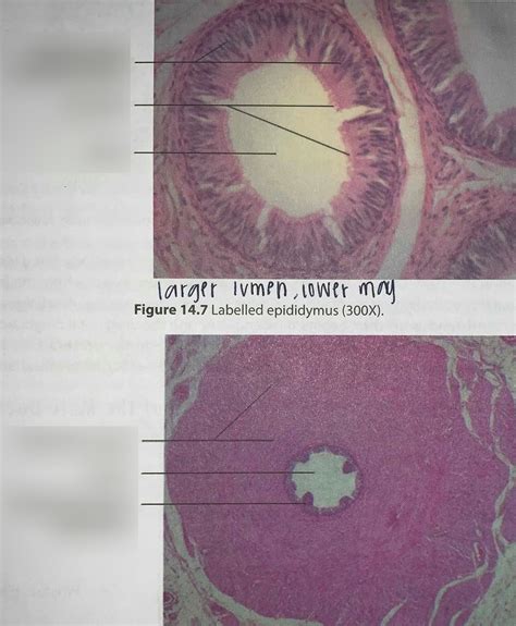 Labeled Epididymis And Ductus Deferens Diagram Quizlet