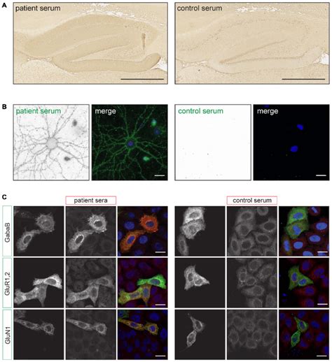 | Examples of staining patterns. (A) Immunohistochemistry (IHC) of rat ... 