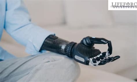 Understanding the Life Expectancy of Modern Prosthetic Arms