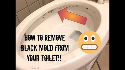 Black Mold Under Toilet Seat At Jim Combs Blog